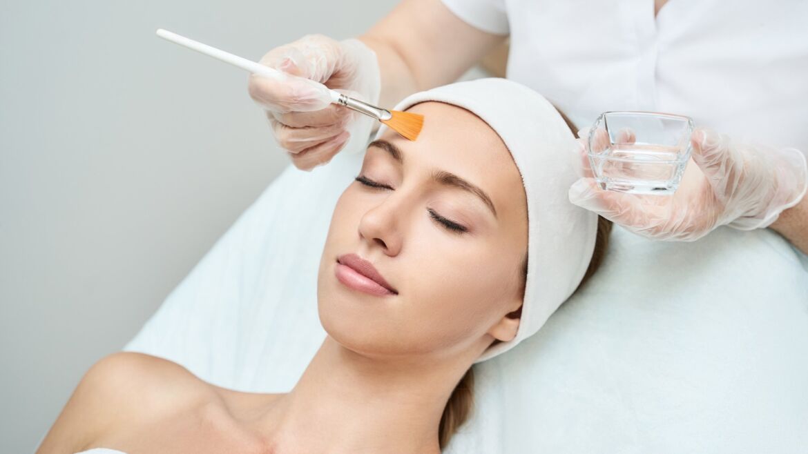 Chemical Peel