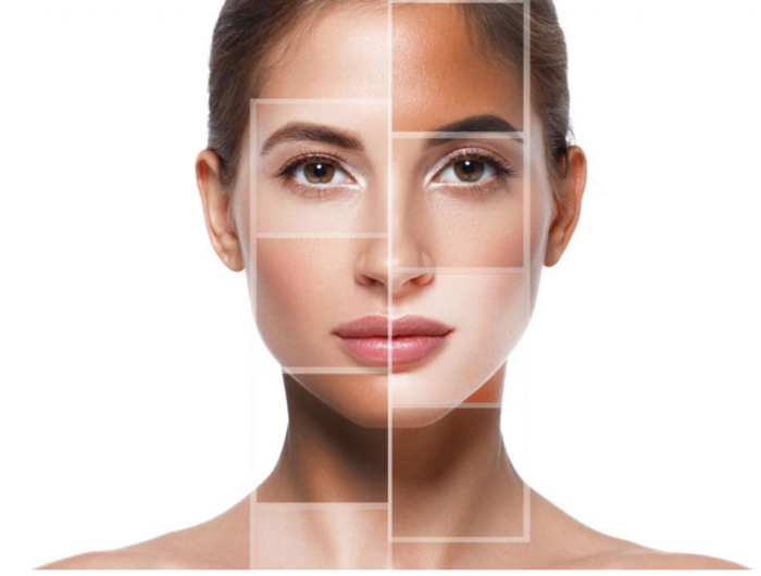 Laser Skin Resurfacing