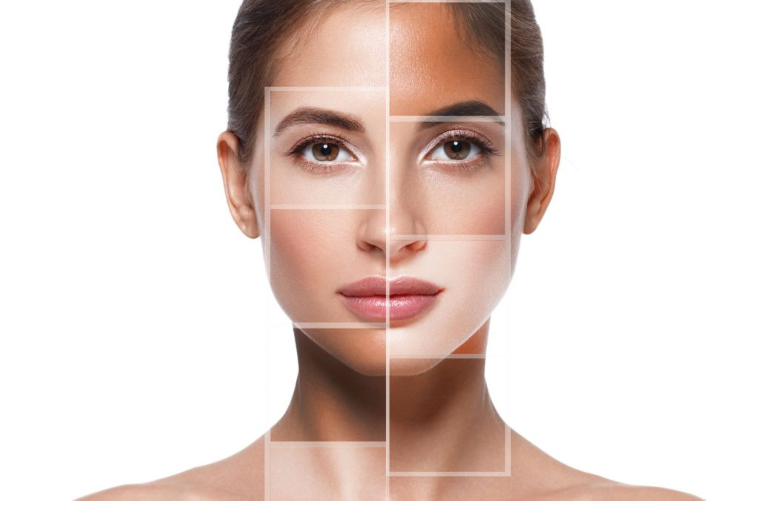 Laser Skin Resurfacing